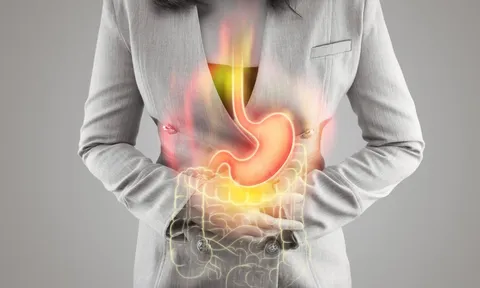 6 loại đồ uống giúp giảm trào ngược axit dạ dày thực quản