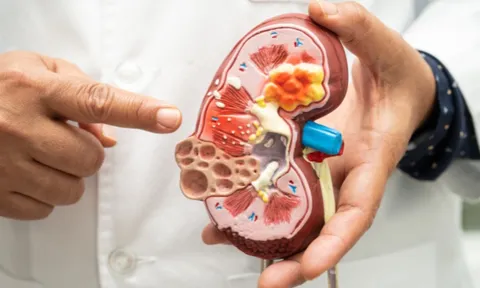 5 biểu hiện vào ban đêm cảnh báo suy thận giai đoạn sớm