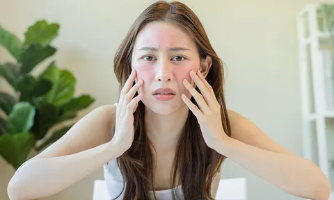 Da chảy xệ: Nguyên nhân và 5 nguyên liệu tự nhiên giúp cải thiện độ săn chắc