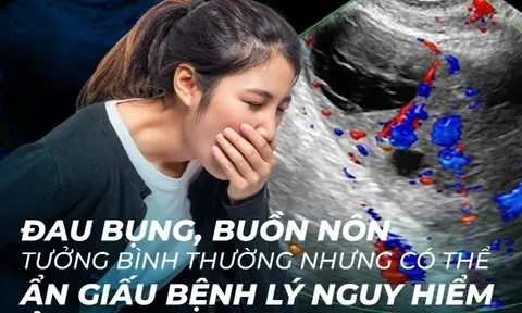 Đi khám vì đau bụng tưởng rối loạn tiêu hóa, phát hiện biến chứng phụ khoa nguy hiểm