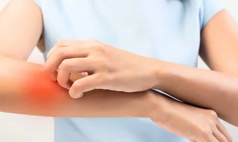 10 triệu chứng xuất hiện trên da cảnh báo tình trạng sức khỏe có vấn đề, cần đến viện kiểm tra sớm