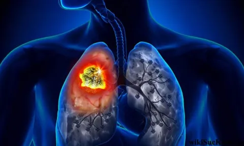 5 dấu hiệu vào buổi tối cảnh báo ung thư: Đặc biệt số 2 rõ ràng mà nhiều người chủ quan