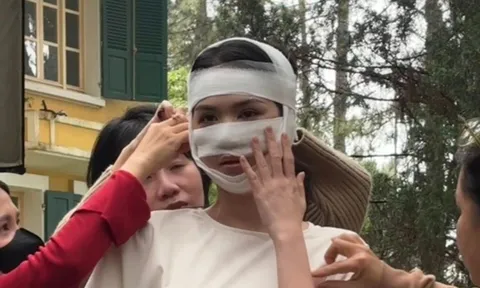 Hình ảnh Ngọc Trinh băng bó kín cả mặt gây hoang mang