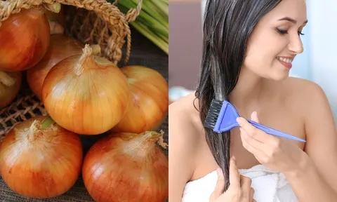 Nước ép hành tây có thực sự giúp mọc tóc? Cách dùng đúng để tránh kích ứng da đầu