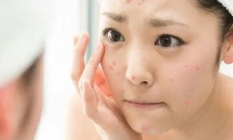 Cô gái mang túi mỹ phẩm mua online đến cầu cứu bác sĩ vì mặt bị dị ứng sau vài lần sử dụng