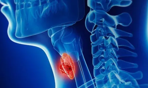 7 dấu hiệu cảnh báo ung thư tuyến giáp giai đoạn 1: Biết sớm có thể chữa khỏi hoàn toàn