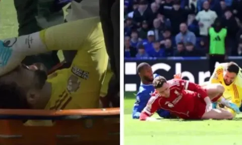 Mamardashvili dính chấn thương nặng ở trận derby Merseyside