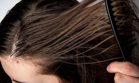 3 thói quen tưởng vô hại khiến tóc nhanh bết và da đầu dễ đổ dầu