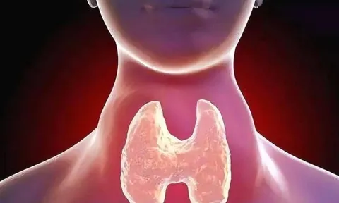 Không được ăn thịt gà khi mắc bệnh tuyến giáp? Cảnh báo 4 nhóm thực phẩm dễ gây dị ứng cần hạn chế