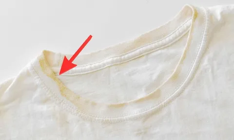 Mẹo làm sạch vết ố vàng trên quần áo trắng bằng baking soda