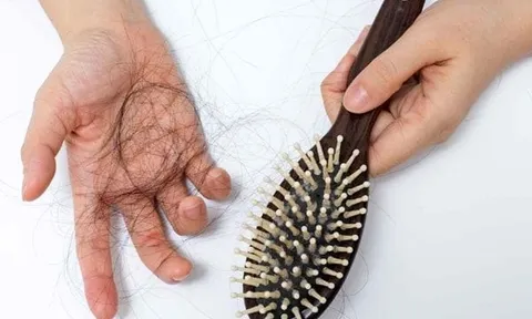 Rụng tóc nhiều: dấu hiệu bình thường hay cảnh báo bất ổn? Cách cải thiện an toàn tại nhà