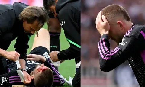 Eric Dier đổ máu khi cứu bóng ngay trên vạch vôi
