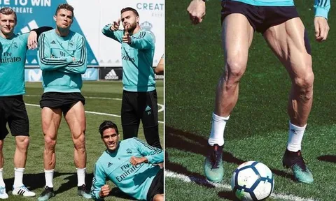 10 danh thủ sở hữu bắp chân 'cực dị': CR7 và 'mục tiêu' của Man Utd