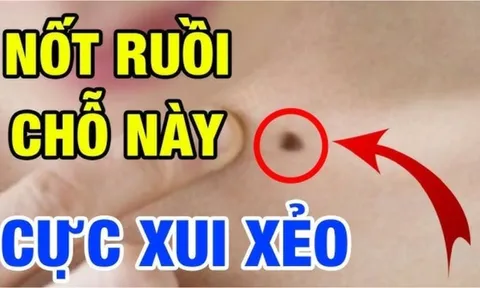 4 nốt ruồi hao tài, nên hóa giải kẻo hao tài khánh kiệt
