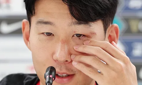 Son Heung-min trông khác lạ khi đeo và tháo mặt nạ