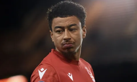 Lingard chỉ trích Man Utd