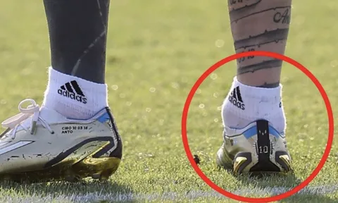 Mắt cá chân bất thường của Messi