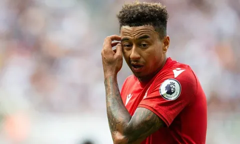 Số nhọ Jesse Lingard