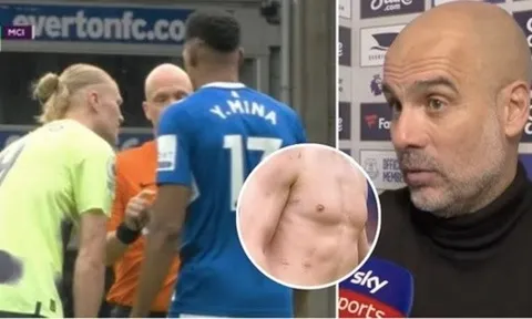 Pep Guardiola sôi máu Haaland bị hậu vệ Everton cào cấu khắp người