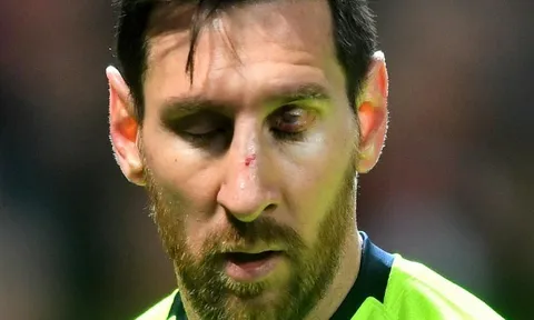 "Mad dog" của Man United lên tiếng về hiểu lầm với Lionel Messi
