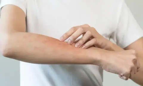 Trời nắng nóng kèm mưa ẩm, đây là tác nhân gây hại sức khỏe cả nhà nhưng rất khó tiêu diệt