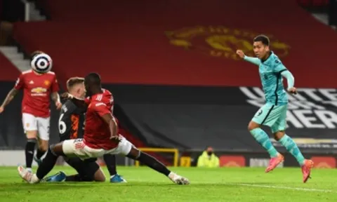 "Bạn chỉ thấy điều đó khi Maguire không thi đấu"