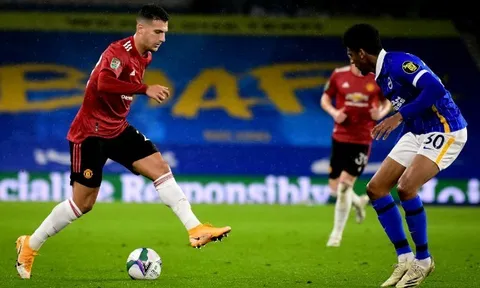 CĐV Man United: "Xem cậu ta chơi bóng thật chướng mắt"