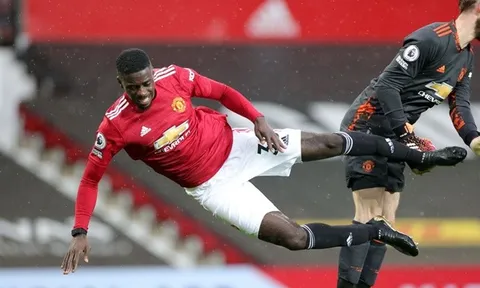 Đã rõ thiết bị Tuanzebe đeo ở trận Leicester