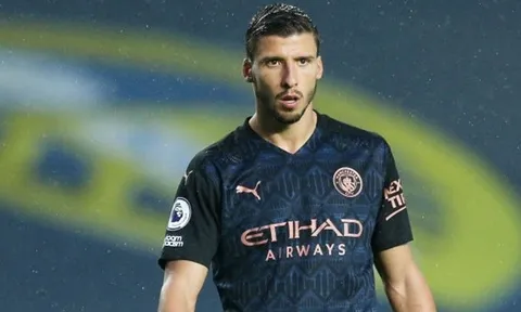 Hòa Leeds, Pep Guardiola dùng 1 từ mô tả 'bom tấn' Dias