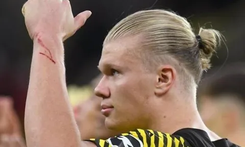 Lý do Haaland và Reus vắng mặt ở trận thua Gladbach