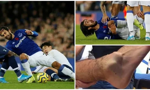 SỐC! Son Heung-min đạp gãy chân cựu sao Barca, khóc ngất rời sân