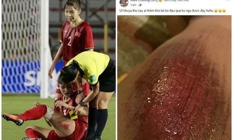 SỐC! Lộ hình ảnh đau đớn chẳng kém "đầu gối đẫm máu" của Trọng Hoàng