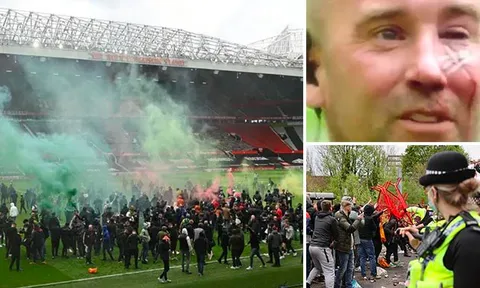 SỐC! Máu đã đổ, CĐV M.U bạo loạn tấn công cả huyền thoại Liverpool