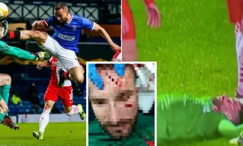 SỐC! 'Tung cước' kinh hoàng, học trò của Gerrard khiến đối thủ đổ máu