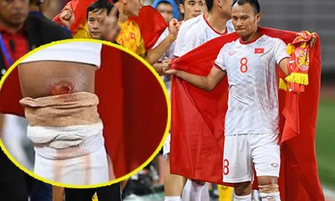 Xót xa! Trọng Hoàng đầu gối rướm máu, đứng lặng lẽ ăn mừng