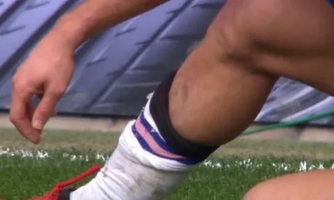 CHOÁNG! Lộ hình ảnh kinh hoàng cú đạp chân của Lo Celso với Azpilicueta