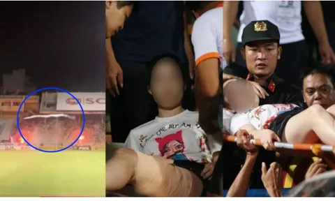 Báo châu Á nói 1 điều về sự cố pháo sáng gây thương tích ở Hàng Đẫy
