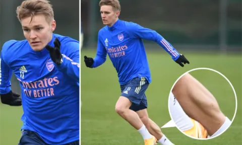 Chỉ với 1 bức ảnh, Odegaard chứng tỏ không hề kém cạnh Grealish