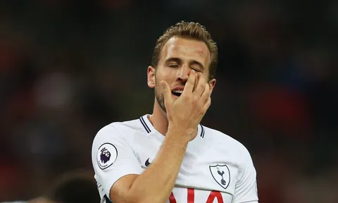 "Cú lừa" Harry Kane xuất hiện tại Man United