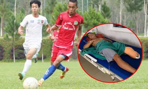 Cựu đội trưởng Đắk Lắk gặp tai nạn kinh hoàng, phải cưa chân để giữ lại mạng sống