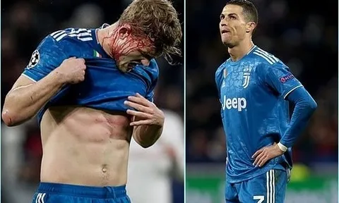De Ligt đổ máu, Ronaldo tịt ngòi, Juventus thất thủ trên đất Pháp