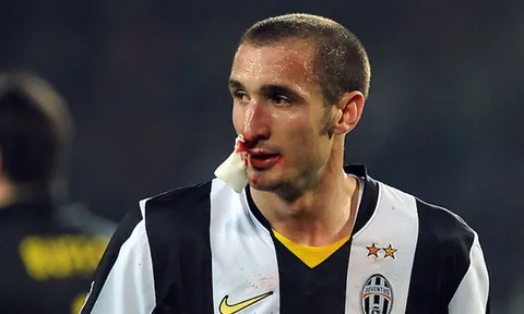 Giorgio Chiellini: Khi máu và mồ hôi tạo nên người đội trưởng vĩ đại