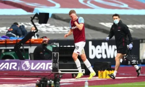 Khuôn mặt đẫm máu, sao West Ham vẫn cười toe toét