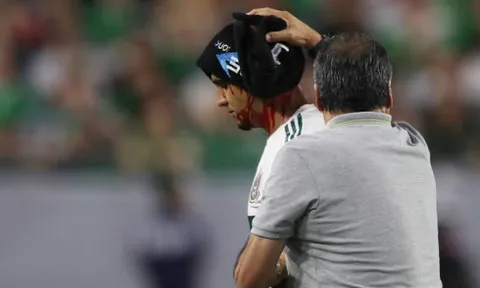 Tổn thương 'kinh hoàng', cầu thủ Mexico vẫn chơi trọn 120 phút