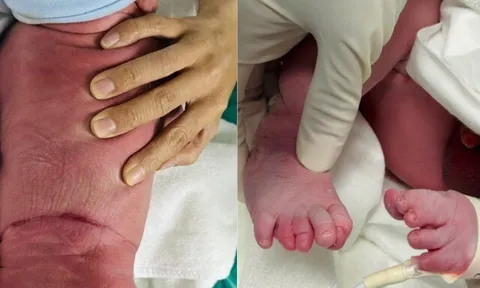 Quyết định ngược dòng giúp thai nhi nguy cơ cao chào đời khỏe mạnh