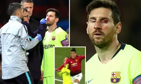 SỐC: Vẻ ngoài 'không thể tin được' của Messi sau cú tát của Smalling