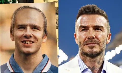 Beckham từng bị dự đoán hói đầu, rụng răng vào năm 2020