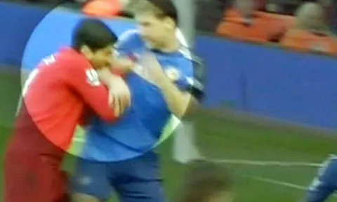 Góc hoài niệm: "Hàm răng vàng" của Suarez