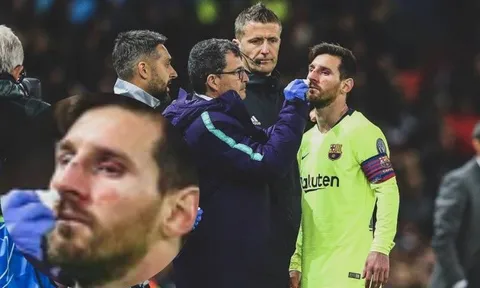 Smalling có thể không biết, nhưng vô tình khám phá ra "điểm yếu" của Messi
