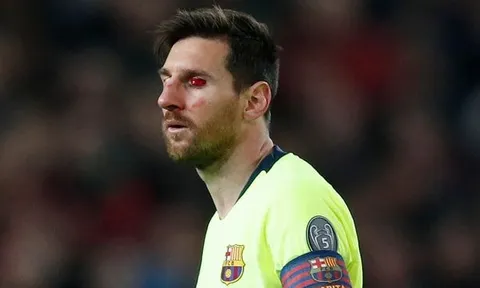 NÓNG! Rõ chấn thương nặng của Messi sau cú đánh từ Smalling